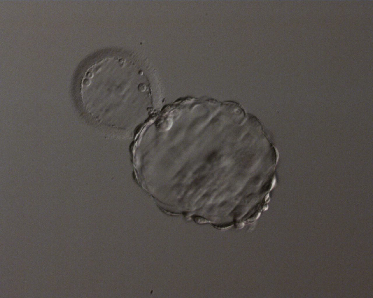 Frozen Embryos How Do They Live Fertility Experiences