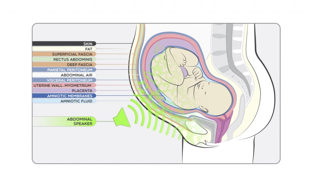 Abdominal ENG